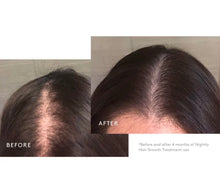 Virtue Flourish Nightly Intensive Hair Growth Treatment Kit (1-Month Supply)